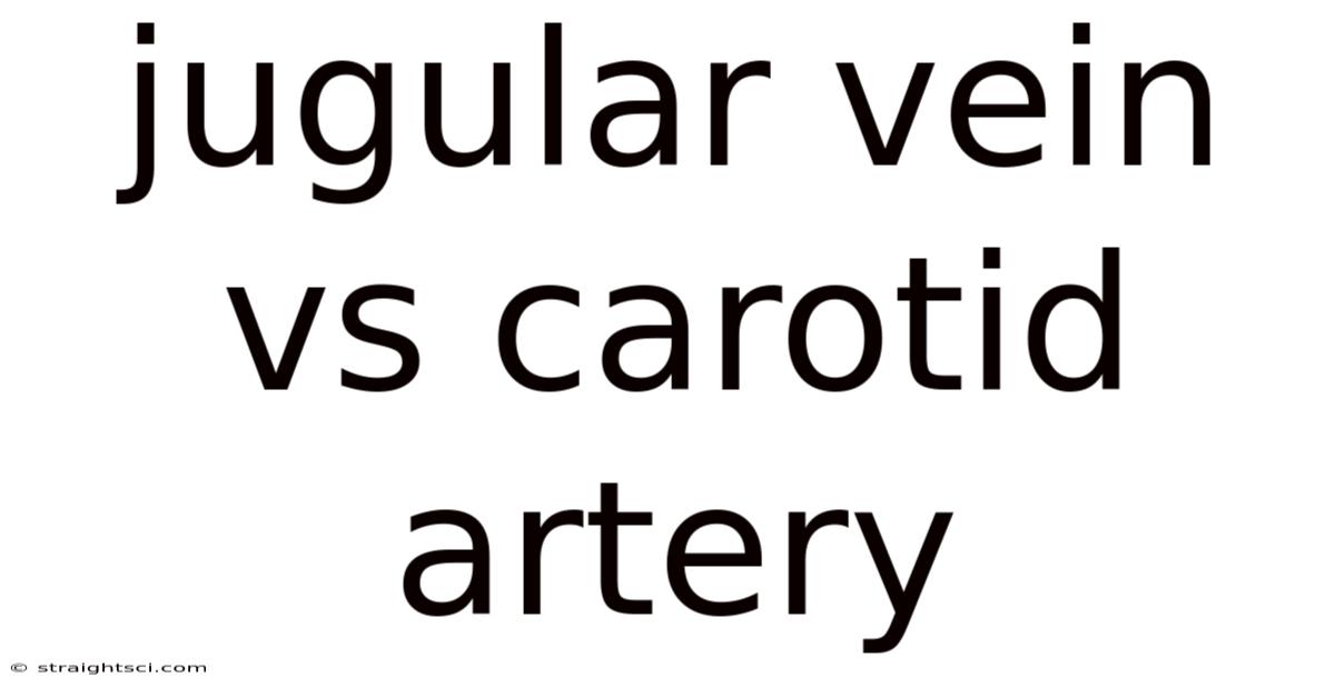 Jugular Vein Vs Carotid Artery