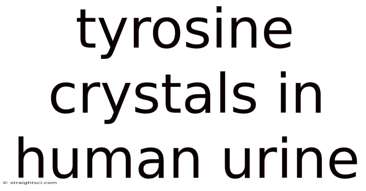 Tyrosine Crystals In Human Urine