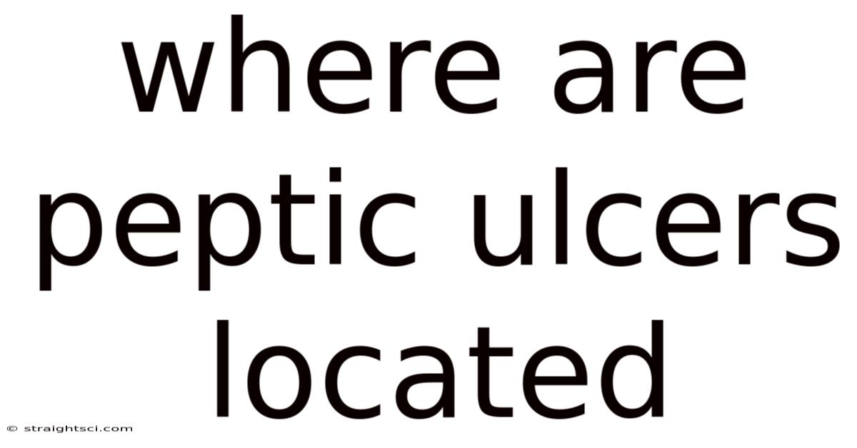 Where Are Peptic Ulcers Located
